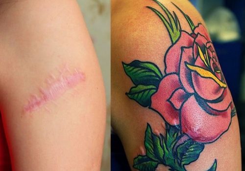 Татуировки, чтобы скрыть шрамы, все, что вам нужно знать