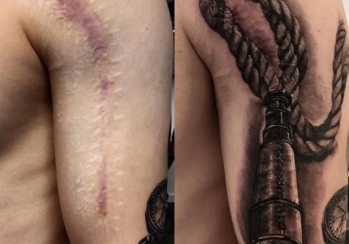 Какими татуировками можно перекрыть шрамы?
